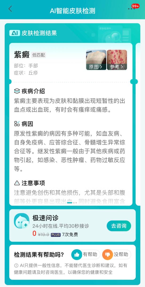 柳絮纷飞易造成过敏 京东健康皮肤医院上线“过敏门诊”