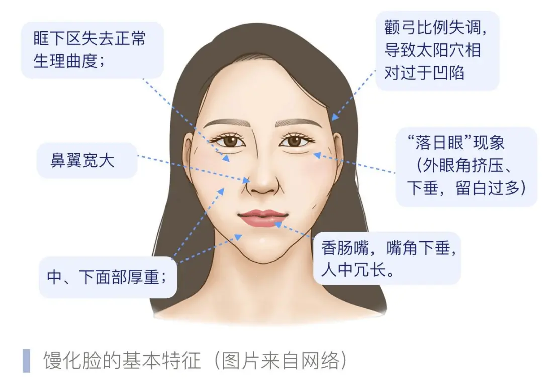 俊泰医疗薛志强博士接受中国医美科普：解析馒化修复诊疗路径