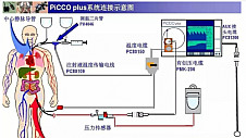 血流动力学之监测选择