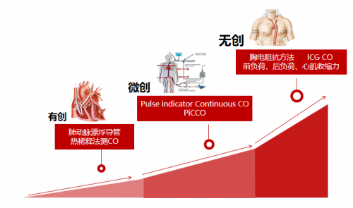 血流动力学之监测选择